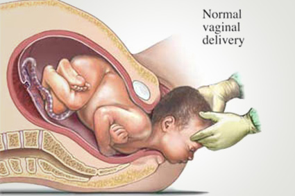 How we ensure the best chance of normal delivery through natural childbirth techniques